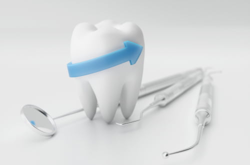 Dental model illustrating coverage concepts under the Canadian Dental Care Plan.