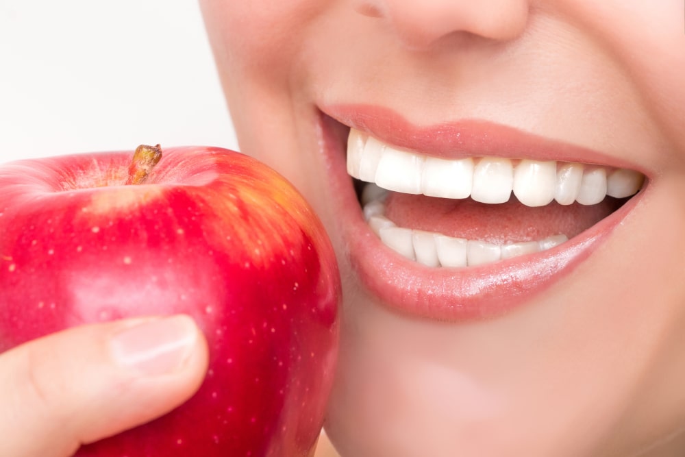 Close-up of a woman’s mouth showing bright white teeth after All-on-4 treatment