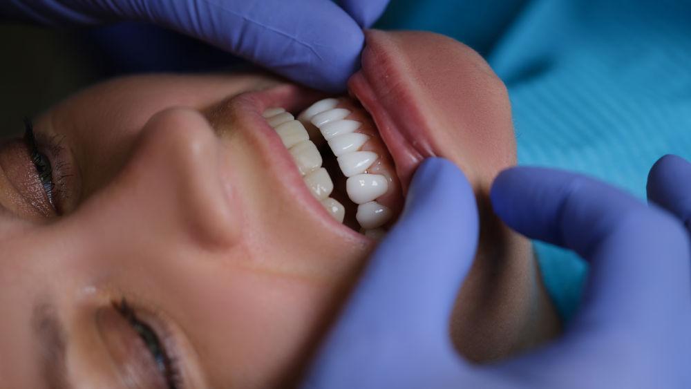Dentist examining a patient’s teeth to assess porcelain veneers for fit, shade matching, and long-term aesthetic results.
