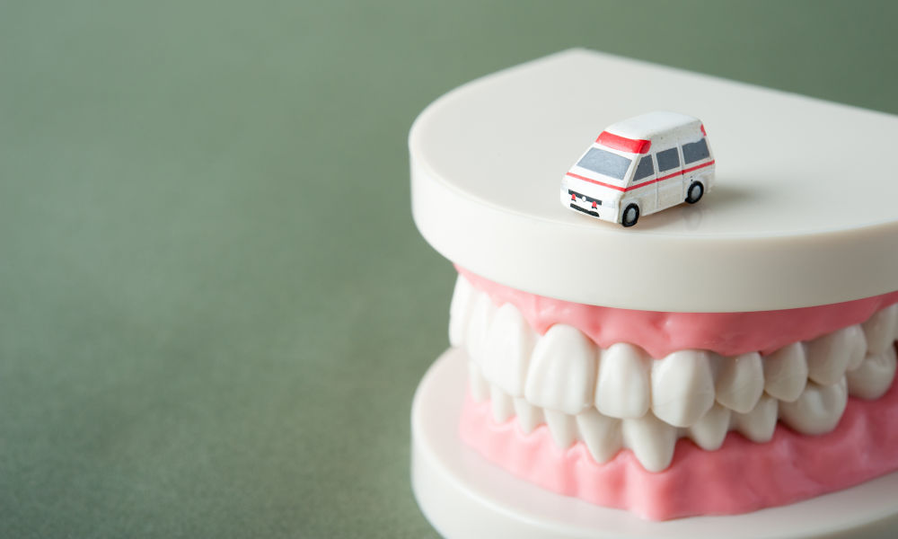 Model of teeth with a miniature ambulance, symbolizing dental emergencies handled by ER or dentist