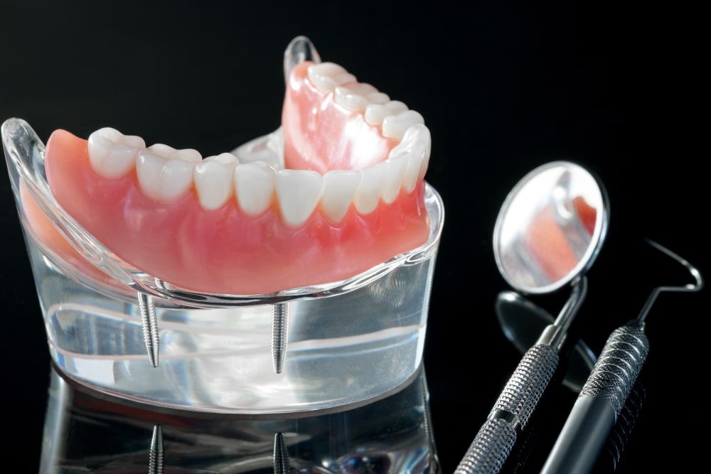 Dental model demonstrating traditional removable dentures with gum base
